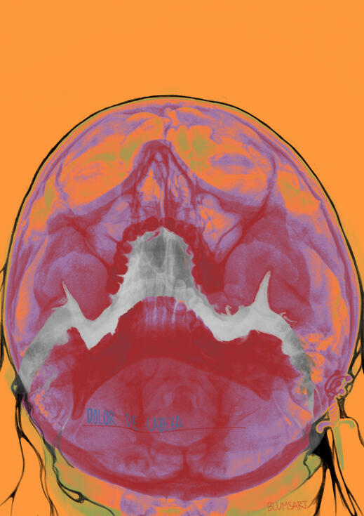 Dolor de Cabeza, 2025 [Headache] ver 2