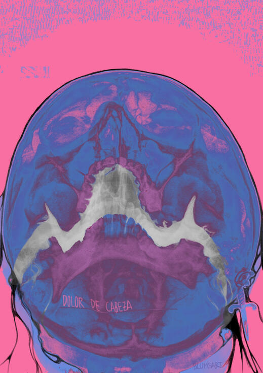 Dolor de Cabeza, 2025 [Headache] ver 1